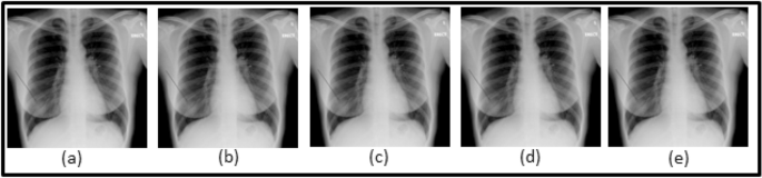 figure 15