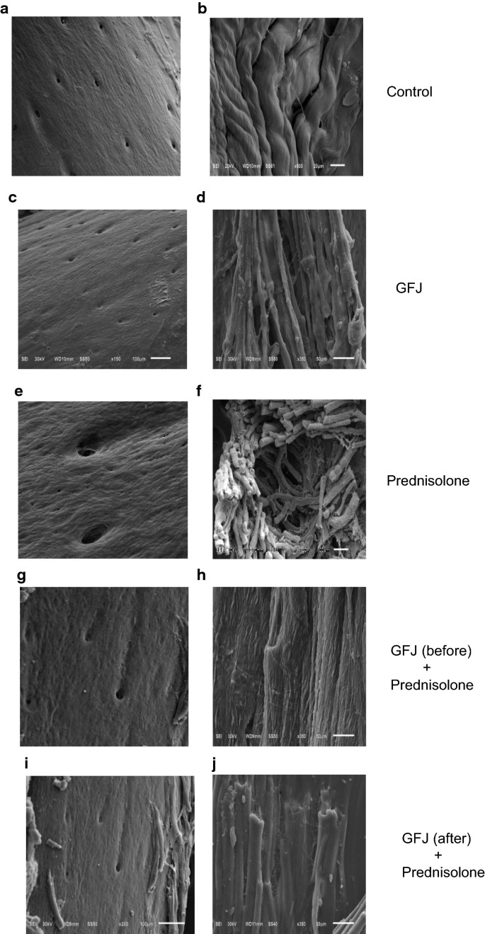 Grapefruit Juice Exerts Anti Osteoporotic Activities In A Prednisolone Induced Osteoporosis Rat Femoral Fracture Model Possibly Via The Rankl Opg Axis Springerlink