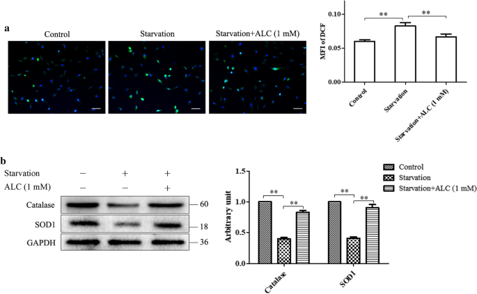 buy acetyl-l-carnitine Acetyl L-Carnitine