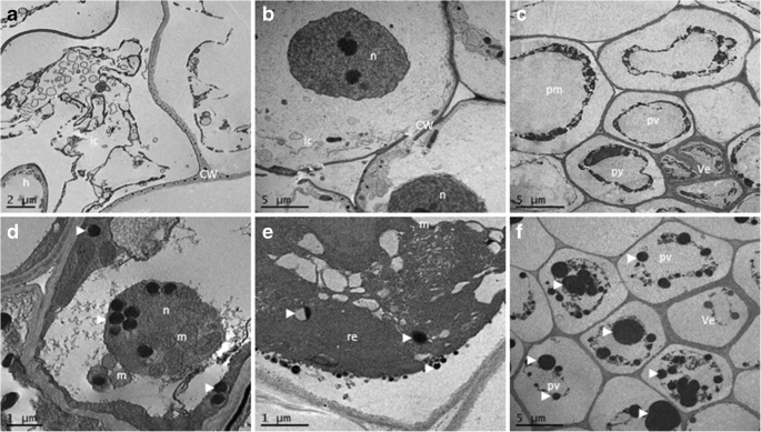 Effect Of Setophoma Terrestri S Sclerotium Cepivorum And Trichoderma Spp On In Vitro Onion Allium Cepa Root Tissues And The Final Yield At The Field Springerlink