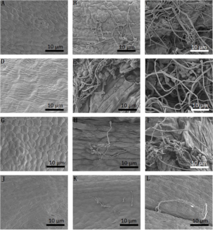 Comparative ultrastructural analysis of Botrytis cinerea infection in ...