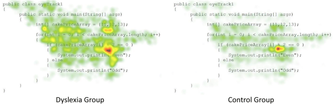 eye tracking disorder eye tracking disorder