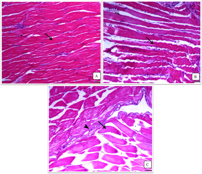 Myostatin-mediated regulation of skeletal muscle damage post-acute