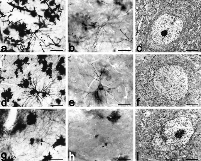 Electron microscopic study of Golgi-impregnated and gold-toned neurons and  fibers in the claustrum of the cat | SpringerLink