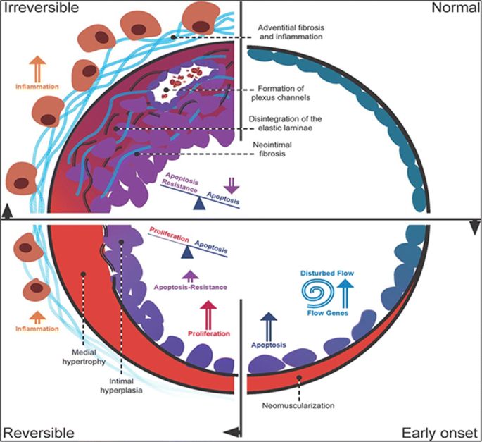 Adult congenital heart disease with pulmonary arterial 