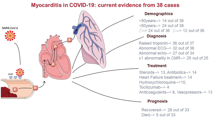 Covid 19 And Myocarditis A Systematic Review And Overview Of Current Challenges Springerlink