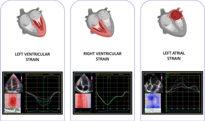 Speckle-Tracking Echocardiography Predicts Adverse Left Ventricular Re