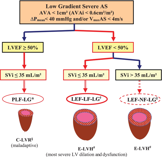 Severe low-gradient aortic stenosis: impact of inadequate left ventricular  responses to high afterload on diagnosis and therapeutic decision-making |  SpringerLink
