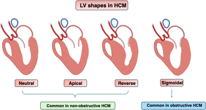 Unveiling the complexity of nonobstructive hypertrophic cardiomyopathy ...