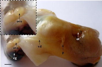 sediment pe penis