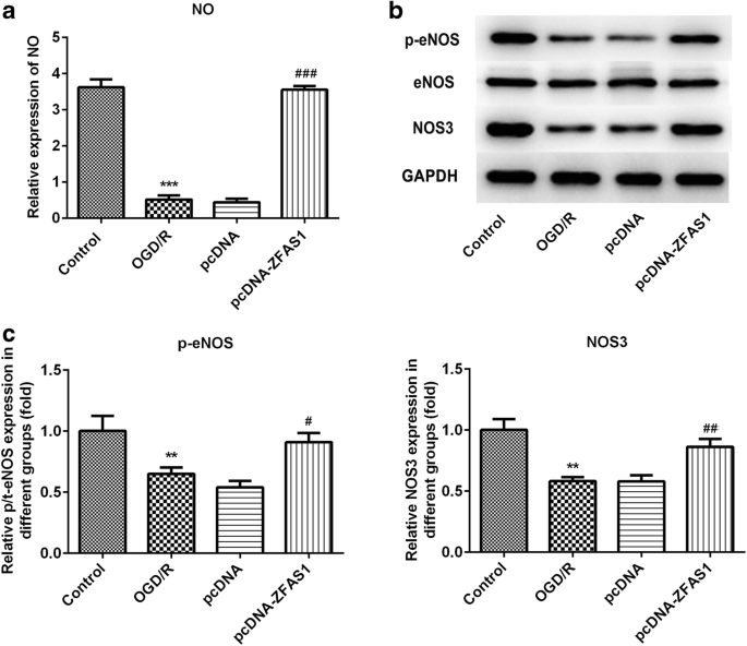 Lncrna Zfas1 Improves Neuronal Injury And Inhibits Inflammation Oxidative Stress And Apoptosis By Sponging Mir 5 And Upregulating Nos3 Expression In Cerebral Ischemia Reperfusion Injury Springerlink Lncrna Zfas1 Improves Neuronal Injury And Inhibits Inflammation Oxidative Stress And Apoptosis By Sponging Mir 5 And Upregulating Nos3 Expression In Cerebral Ischemia Reperfusion Injury Springerlink