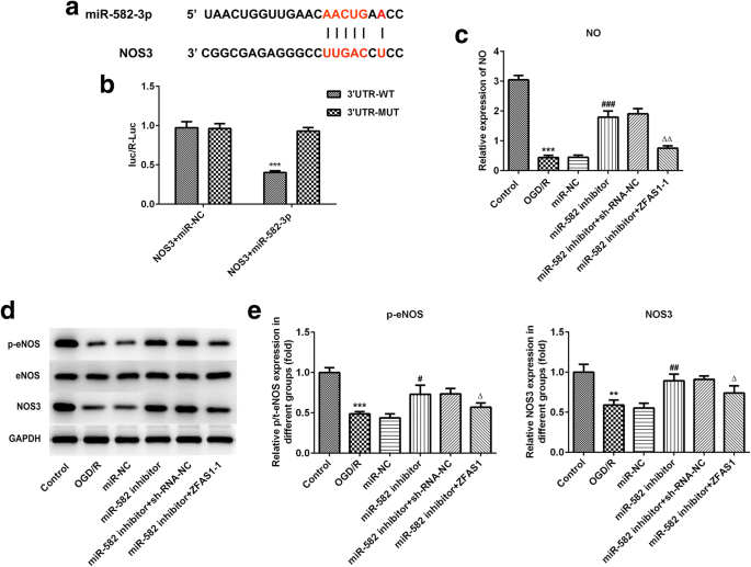 Lncrna Zfas1 Improves Neuronal Injury And Inhibits Inflammation Oxidative Stress And Apoptosis By Sponging Mir 5 And Upregulating Nos3 Expression In Cerebral Ischemia Reperfusion Injury Springerlink Lncrna Zfas1 Improves Neuronal Injury And Inhibits Inflammation Oxidative Stress And Apoptosis By Sponging Mir 5 And Upregulating Nos3 Expression In Cerebral Ischemia Reperfusion Injury Springerlink