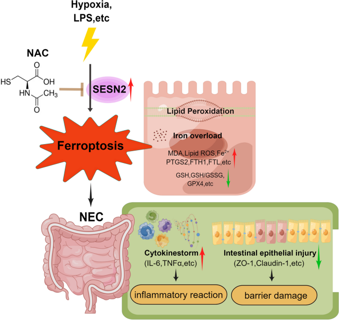 benefits of enteric s-acetyl glutathion N-Acetylcysteine Alleviates Necrotizing Enterocolitis by Depressing SESN2 Expression to Inhibit Ferroptosis in Intestinal Epithelial Cells | Inflammation Is BeautyWhite YouGlowBabe Soap