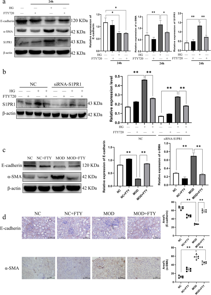 Effects of the S1P/S1PR1 Signaling Pathway on High Glucose-Induced NRK ...