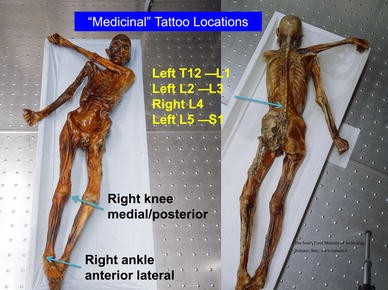 Strange New Tattoo Discovered On Ötzi The Iceman Mummy  HuffPost Impact