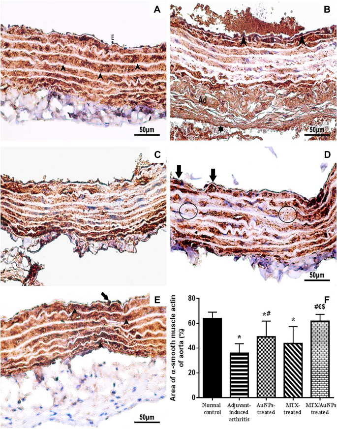 Rat resistance to rheumatoid arthritis induction as a function of the  early‐phase adrenal–pineal crosstalk - Córdoba‐Moreno - 2023 - The Journal  of Physiology - Wiley Online Library