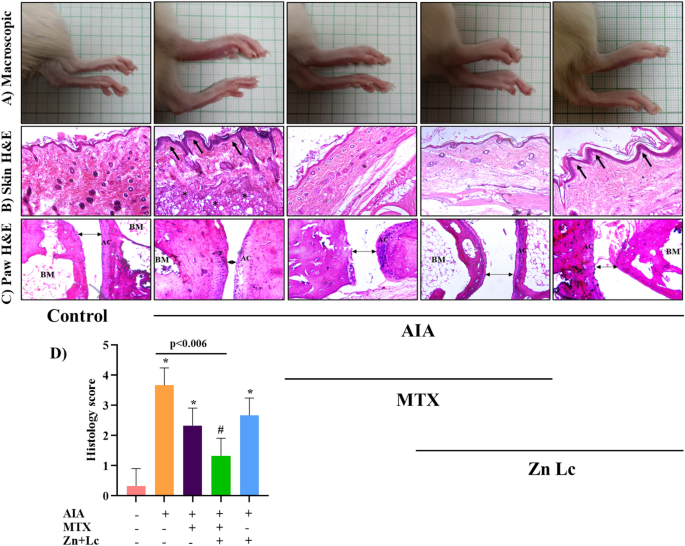 Zinc and L-carnitine combination with or without methotrexate prevents  intestinal toxicity during arthritis treatment via Nrf2/Sirt1/Foxo3  pathways: an In vivo and molecular docking approach | Inflammopharmacology  | Springer Nature Link