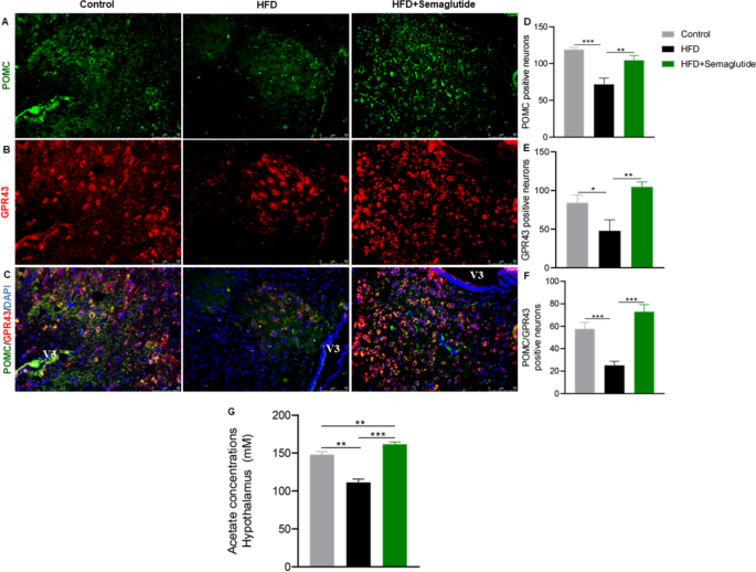 semaglutide microbiome Anorexigenic and anti-inflammatory signaling pathways of semaglutide via  the microbiota–gut––brain axis in obese mice | Inflammopharmacology