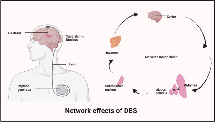 Gut microbiota and Parkinson's Disease: a new frontier in understanding  neurological health | Inflammopharmacology | Springer Nature Link