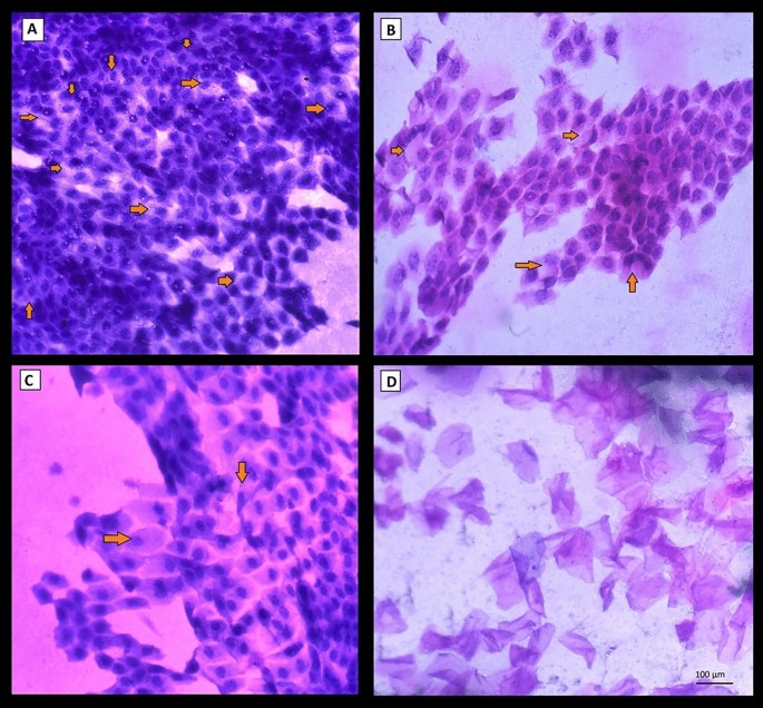 figure1