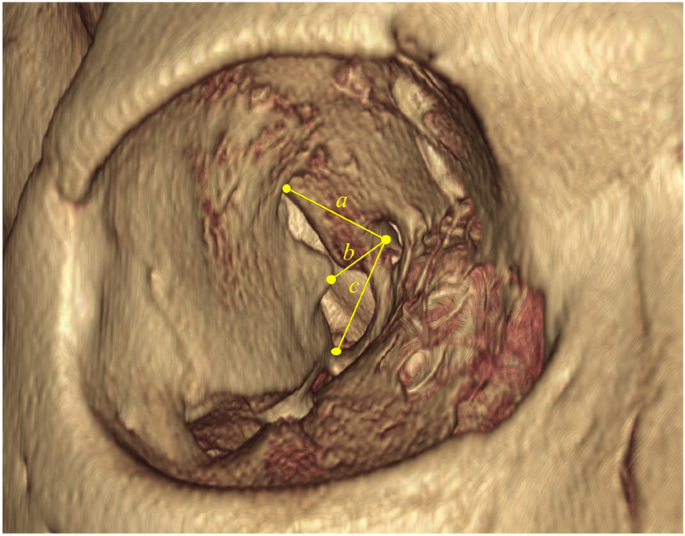 Morphometric evaluation of the anatomical relationships between 