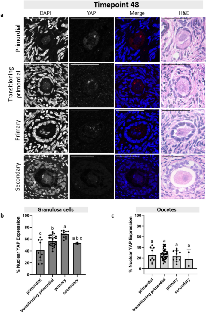 Dynamics of YAP localization and transcript activity in human oocytes ...