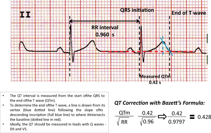 Recommendations for the measurement of the QT interval during the use of  drugs for COVID-19 infection treatment. Updatable in accordance with the  availability of new evidence | SpringerLink