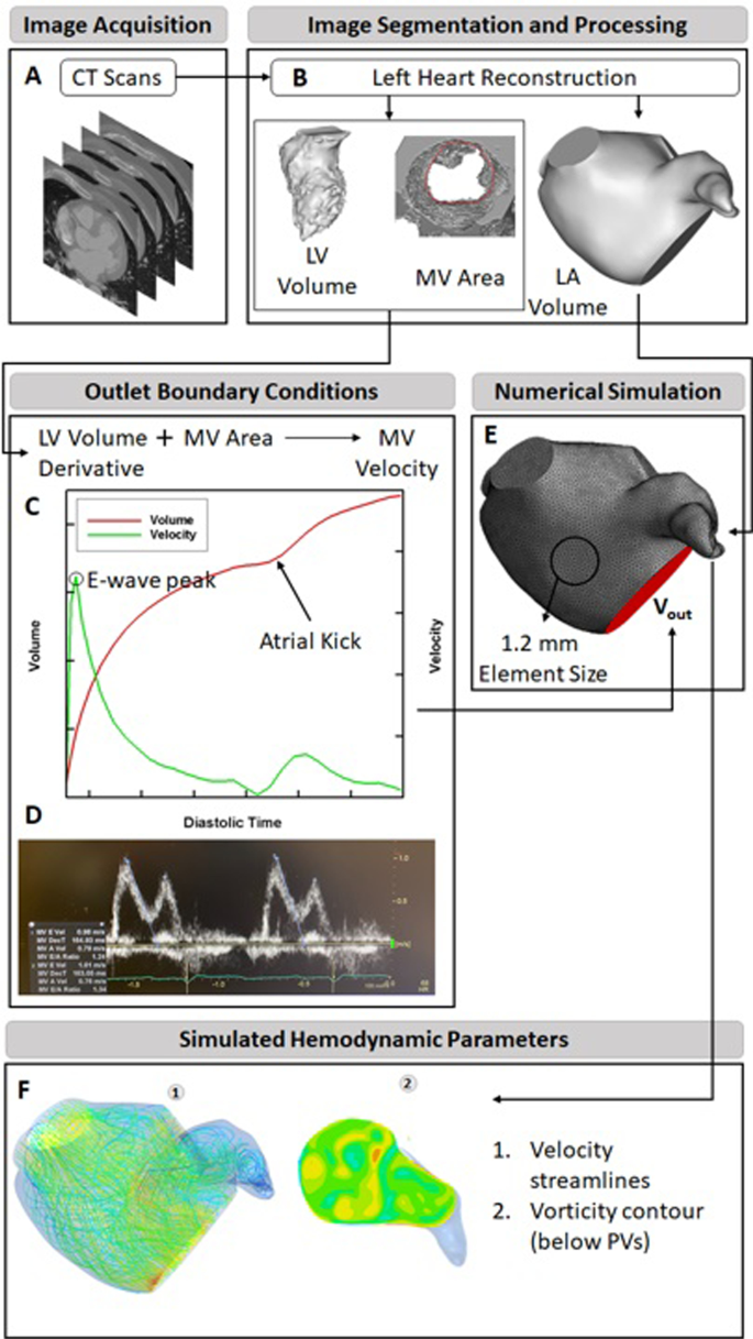 Effect Of Catheter Ablation On The Hemodynamics Of The Left Atrium Springerlink