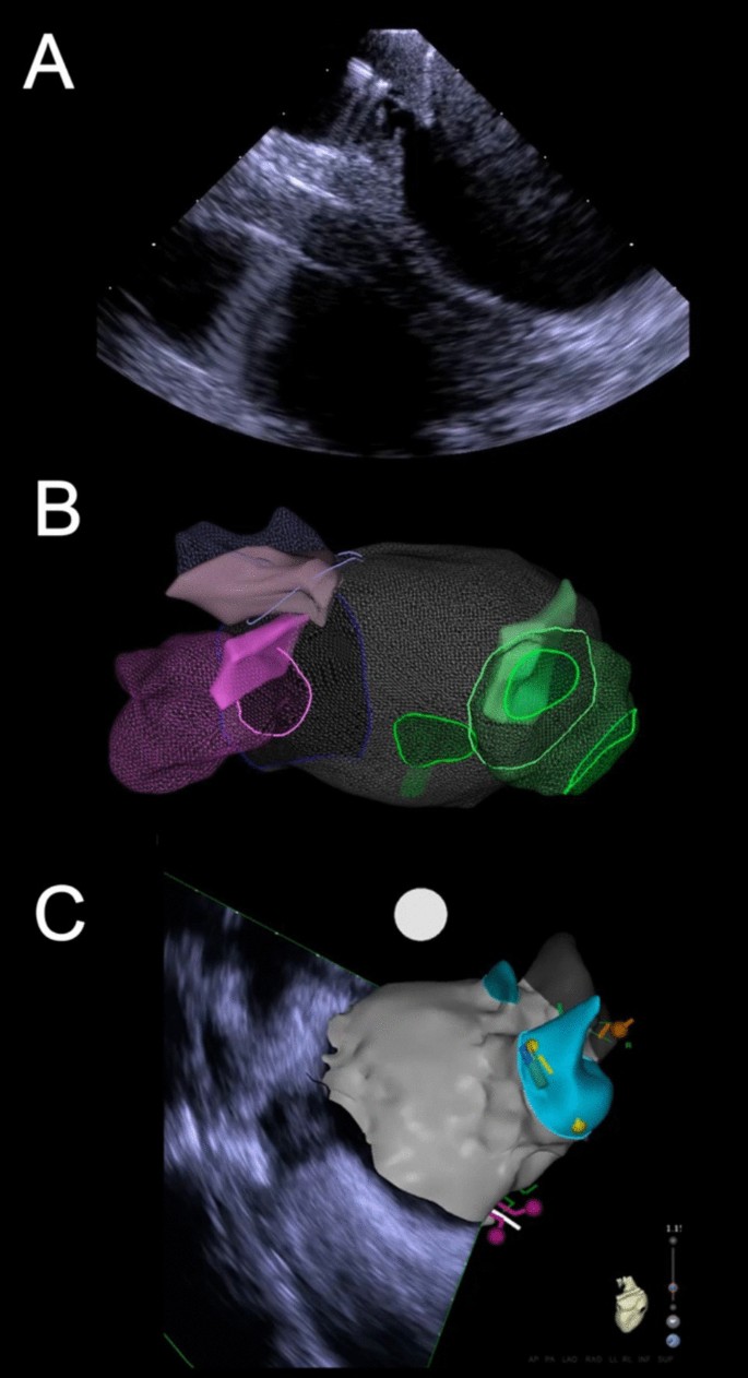Lifetime effects and cost-effectiveness of standard and higher-intensity  statin therapy across population categories in the UK: a microsimulation  modelling study - The Lancet Regional Health – Europe, image size:685x1262