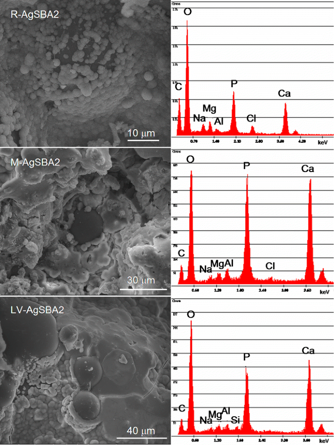 Composites Bone Cements With Different Viscosities Loaded With A Bioactive And Antibacterial Glass Springerlink