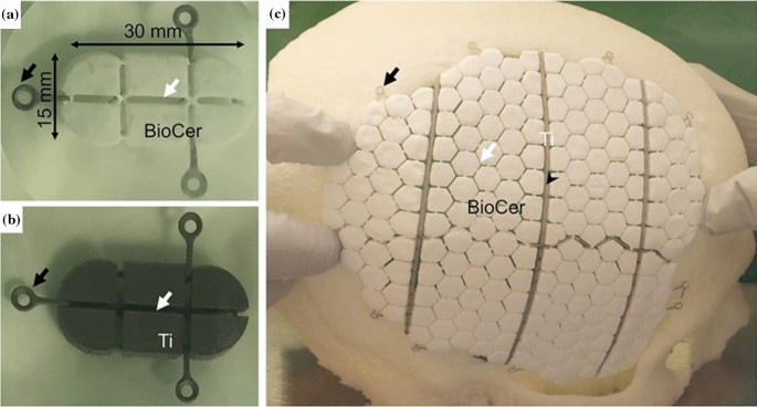 figure 15