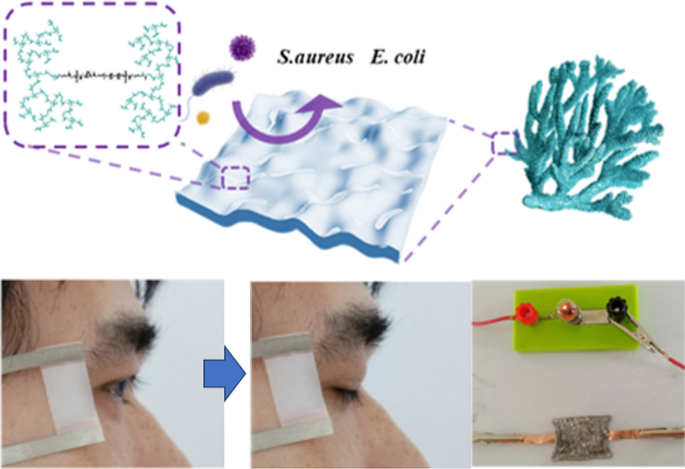 Bioinspired UV-curable self-healing polysiloxane electronic skin with ...