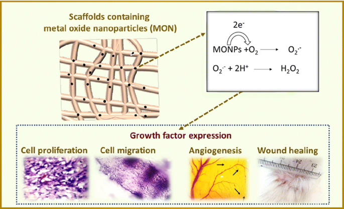 figure 16