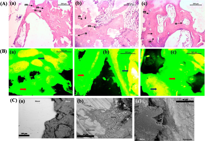 Role Of Calcium Phosphate And Bioactive Glass Coating On In Vivo Bone Healing Of New Mg Zn Ca Implant Springerlink