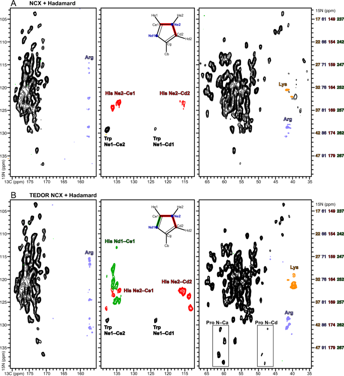 Solid state NMR spectral editing of histidine, arginine and lysine ...