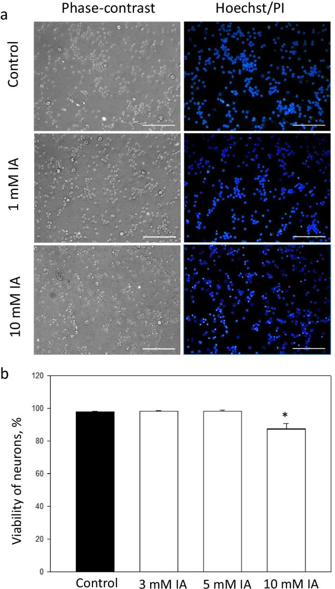 Effects of itaconic acid on neuronal viability and brain mitochondrial  functions | SpringerLink