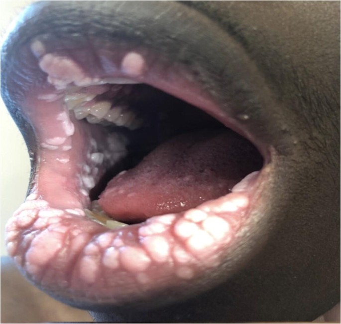 Tongue Inside Foreskin