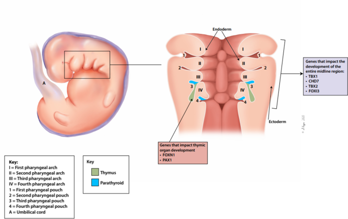 Congenital Athymia: Genetic Etiologies, Clinical Manifestations, Diagnosis,  and Treatment | Journal of Clinical Immunology