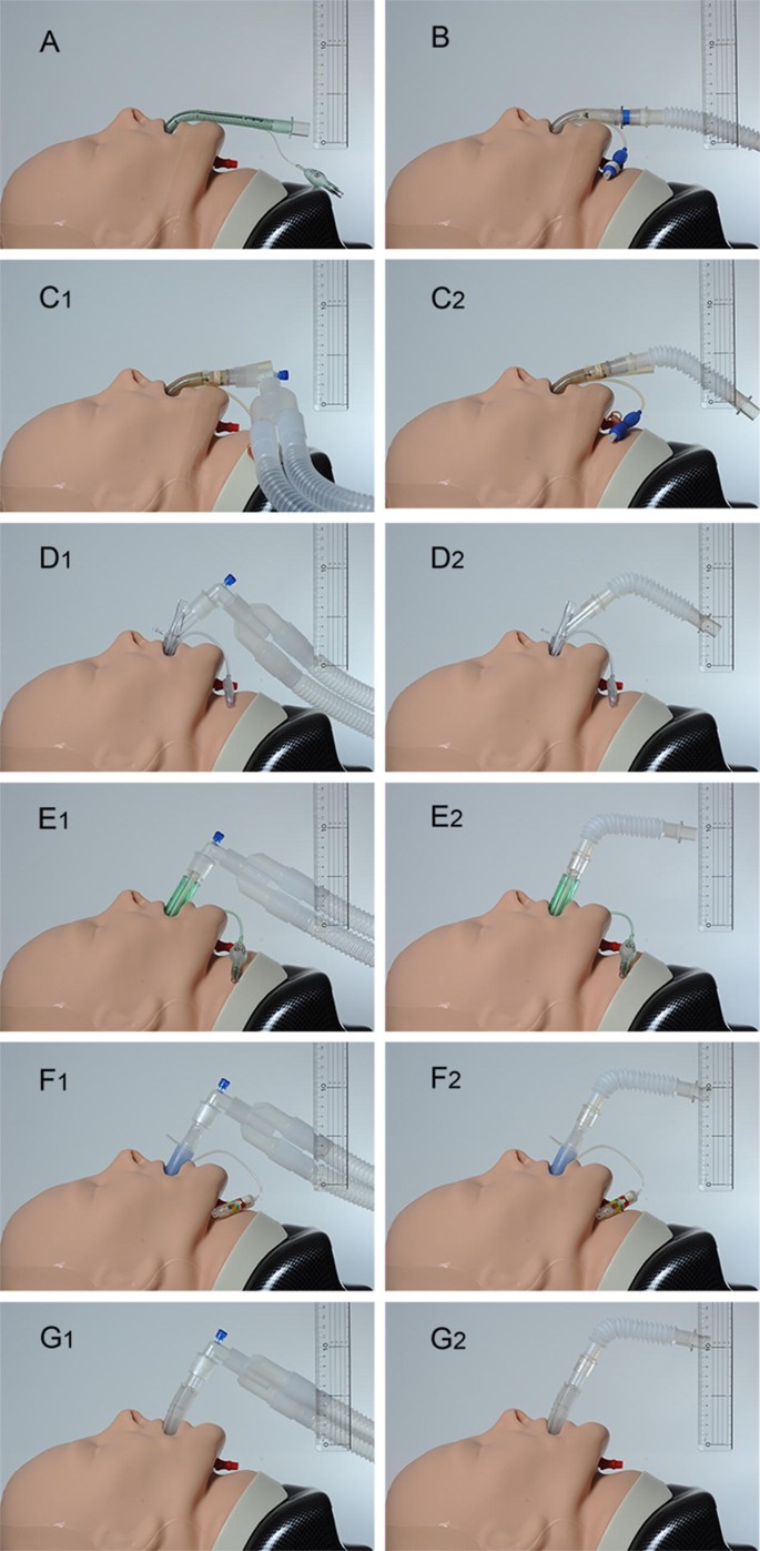 Laryngeal tube - Wikipedia, image size:685x1397
