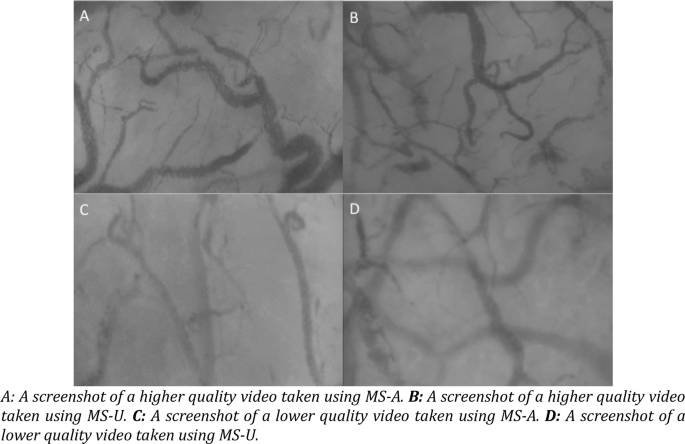 A Comparison Of The Quality Of Image Acquisition Between Two Different Sidestream Dark Field Video Microscopes Springerlink