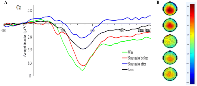 Neurophysiological Correlates of the Near-Miss Effect in Gambling | Journal of Gambling Studies