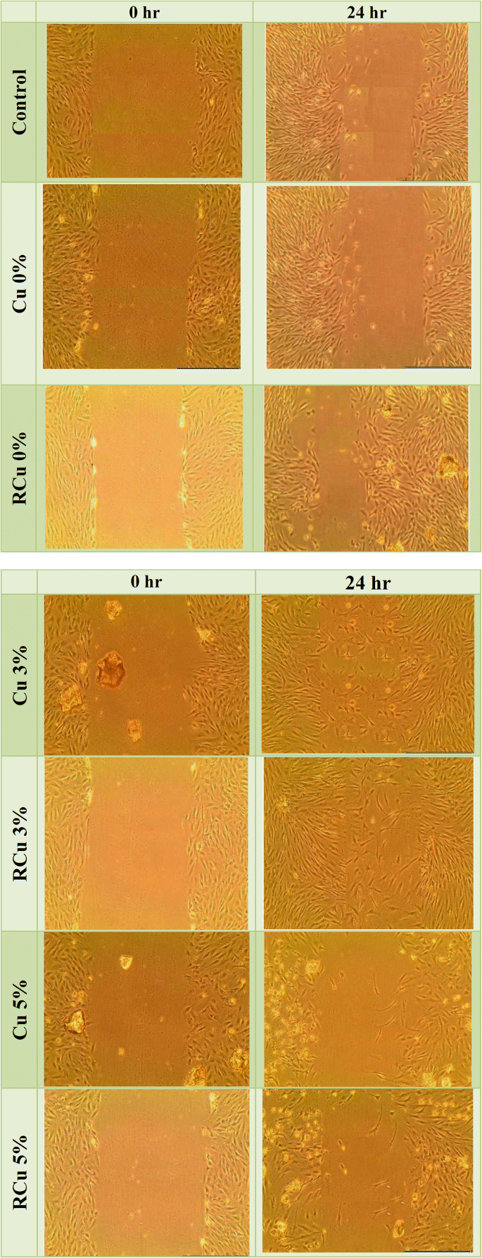 The Dual Effect Of Copper And Gamma Irradiation On Chronic Wound Healing Of Nanobioactive Glass Springerlink