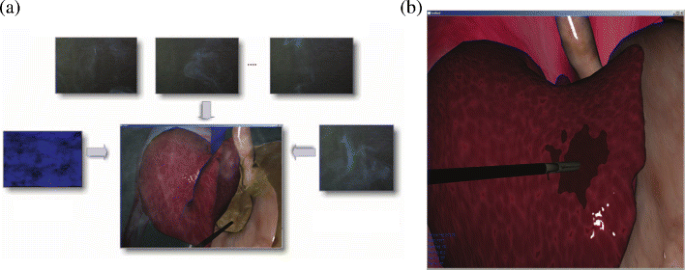 figure 11