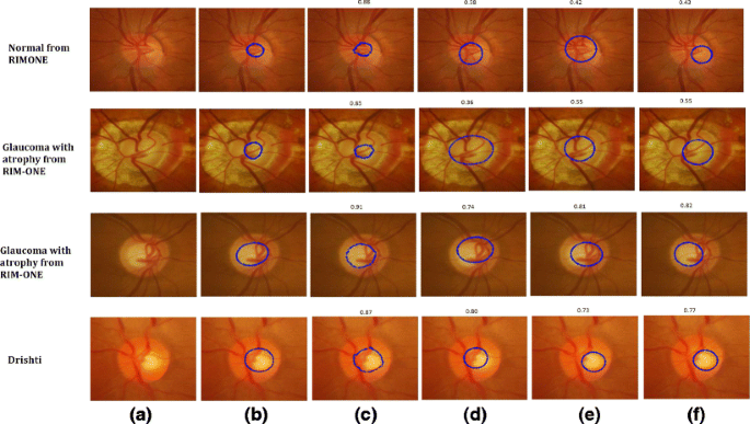 figure 14