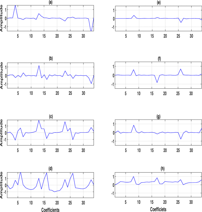Detection of Atrial Fibrillation from Single Lead ECG Signal Using  Multirate Cosine Filter Bank and Deep Neural Network | SpringerLink