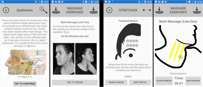 Cloud Computing Mobile Application For Remote Monitoring Of Bell S Palsy Springerlink