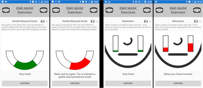 Cloud Computing Mobile Application For Remote Monitoring Of Bell S Palsy Springerlink