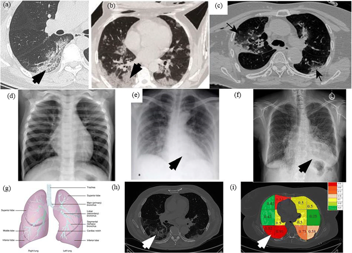 figure 25