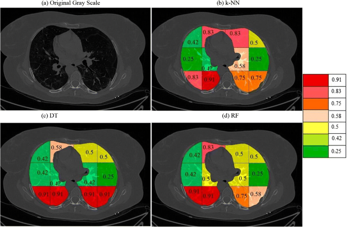 figure 35