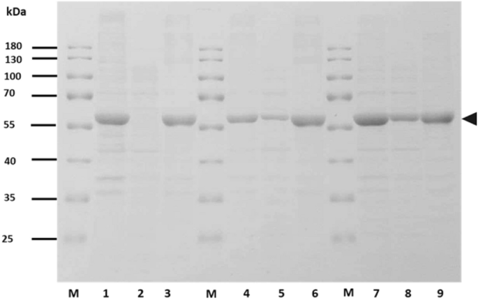 Avian Myeoblastosis Virus (AMV) Moloney Murine Leukemia Virus (MMLV) , HIV  Reverse Transcriptase 